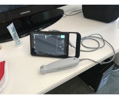 ECOGRAFO TASCABILE PER IL 118 DI RIMINI ECOGRAFO TASCABILE PER IL 118 DI RIMINI